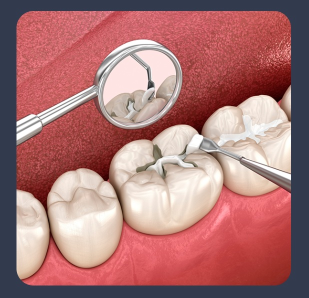 Your Treatment Options