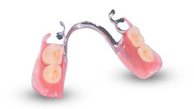 Partial Denture